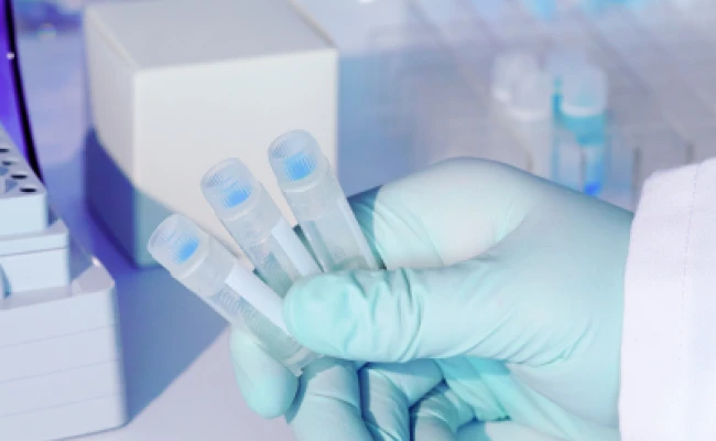 Kit de diagnóstico rápido de laboratorio